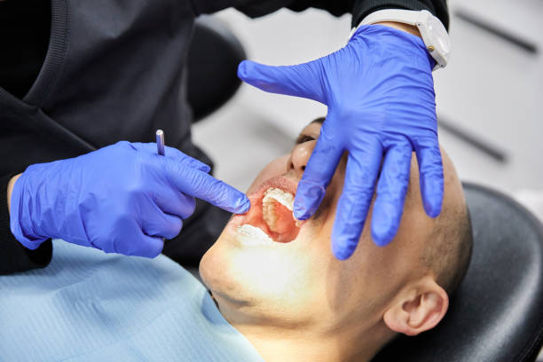 Best Emergency Wisdom Tooth Extraction in West Point, NY